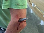 Man in a kayak left with a huge fisherman's SINKER stuck in his arm 