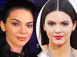Kendall Jenner denies having plastic surgery and getting lip fillers