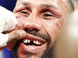 James DeGale loses his front tooth in grueling draw with Badou Jack