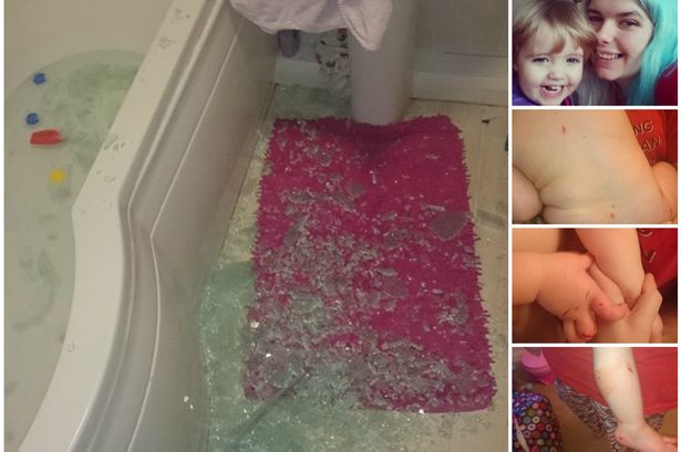 Baby 'cut to shreds' after shower screen explodes