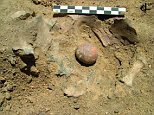 Sudan skeleton had prostate stones the size of walnuts 