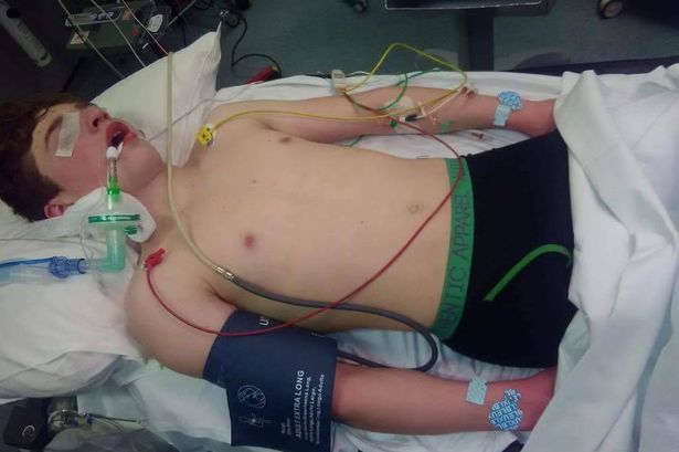 Old Colwyn boy, 14, left in coma after being 'spiked with ecstasy'