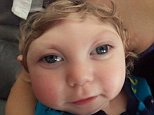 Toddler with brain malformation outlives expectations