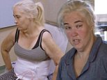 Mama June hates skin removal and cancels second round