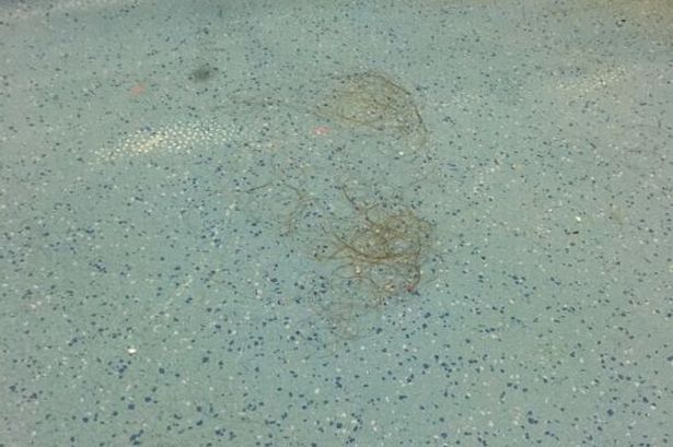 Clumps of hair and blood left in shower room for THREE DAYS at Ysbyty Gwynedd