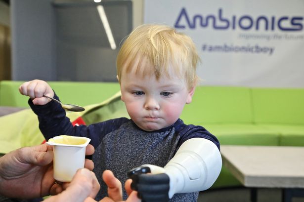 Anglesey man designs son's bionic arm using Xbox scanner and 3D printer
