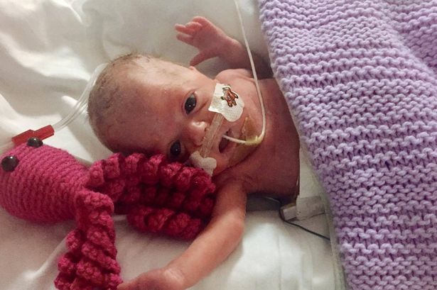 Meet the miracle baby who was given just a 20% chance of survival – but beat the odds