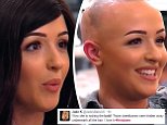 Girl with alopecia bravely removes her wig