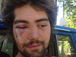 Man left blind after brutally bashed ‘homophobic’ attack