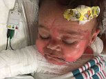 Four-month-old Tennessee boy recovering from severe burns