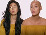 ANTM contestant with alopecia feels 'free' without her wig