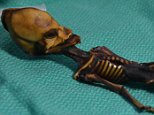 Mummy of a Atacama 'space alien' with a cone-shaped head is human