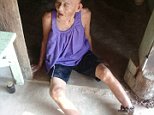 Frail grandmother with Alzheimer's found CHAINED to a door in Thailand