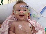 First toddler to receive world's smallest heart valve celebrates 3-year anniversary of procedure
