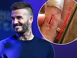 David Beckham suffers excruciating injury as he displays VERY deep bloodied cut on finger