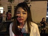 Teenager is left with a knife stuck in her FACE after she is robbed in Malaysia 