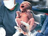 Three-minute check could halve number of premature births
