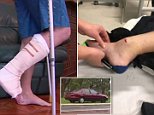 Perth couple brutally beaten after a group of teenagers tell them their friend has been injured