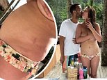 Chrissy Teigen reveals her stretch marks and displays 'mom bod' as she admits she's 'super insecure'