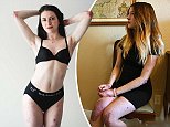 Student who suffers a rare skin tearing condition stars in lingerie campaigns 