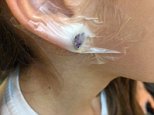 Mother slams Claire's Accessories after seven-year-old daughter's earring becomes stuck in skin