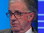 Mark Lawrenson: 'TV viewer first noticed cancer mark on his face'