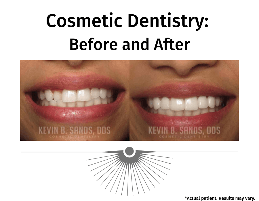 Difference Between a Cosmetic Dentist and a Regular Dentist